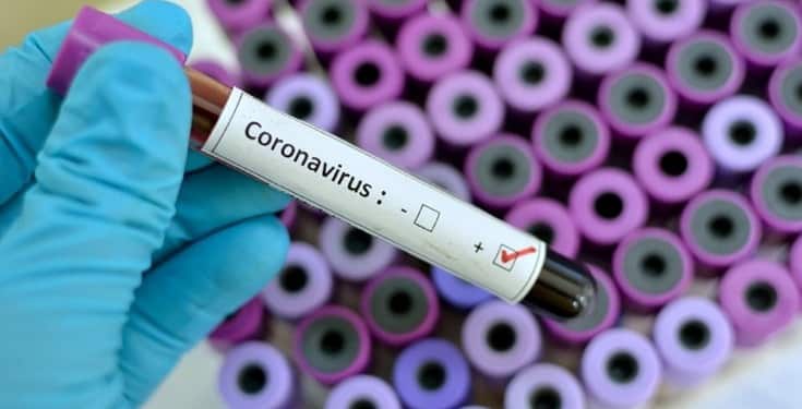 BREAKING: Third Case Of Corona Virus Confirmed In Lagos