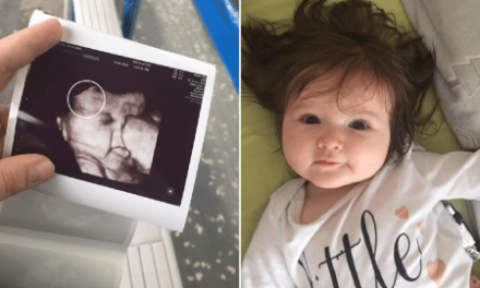 Baby born with head of thick hair that you could see it on the scan (photos)