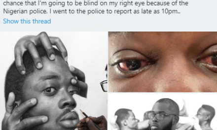 “There’s a 50/50 chance I’m going to be blind” – artist Arinze Stanley