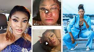 “After two years plus that I was shot, some pellets still coming out “ – Actress Angela Okorie describes her near-fatal encounter with gunmen